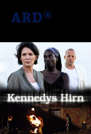 Kennedys Hirn (2010)