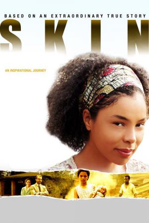 Skin – Schrei nach Gerechtigkeit (2008)