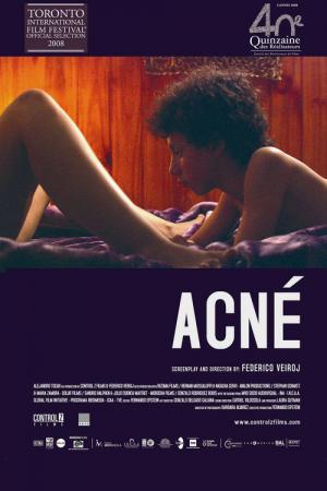 Acné (2008)