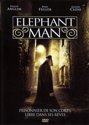 Der Elefantenmensch (1982)